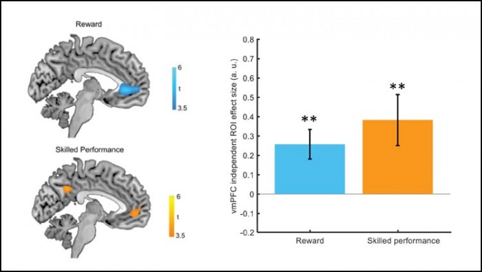 vmPFC-Brain-Activity.jpg