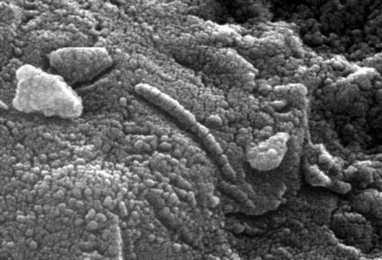 　火星陨石中类似微生物的结构 / ESA